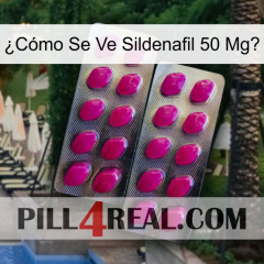 ¿Cómo Se Ve Sildenafil 50 Mgo 10